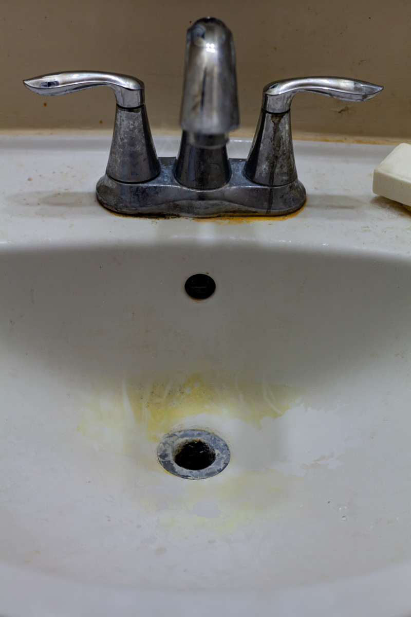 The “Pink Stuff” Magically Cleans the Hard Yellow Stains off Sinks and
